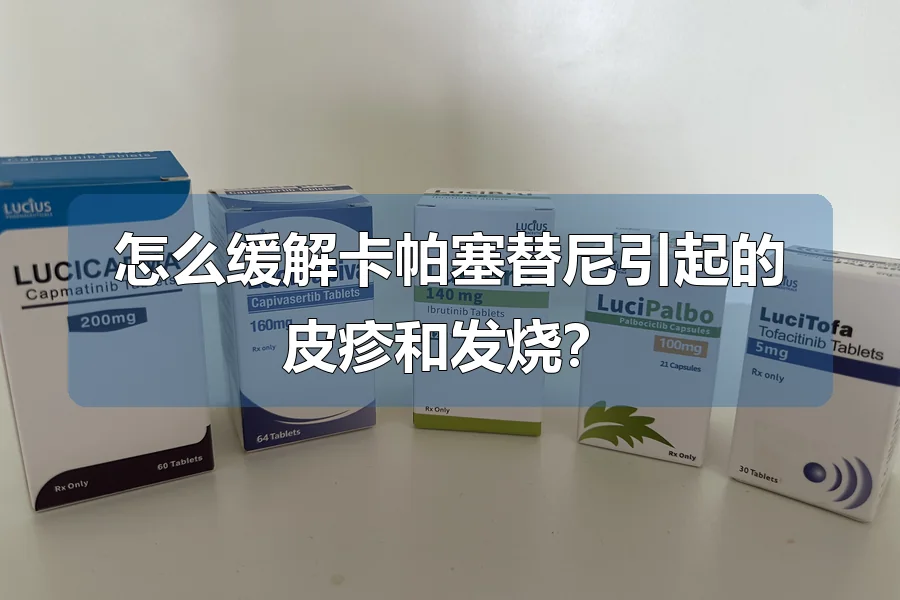 怎么缓解卡帕塞替尼引起的皮疹和发烧?